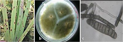 Biochemical Profiling of Resistant Phenotypes Against Bipolaris oryzae Causing Brown Spot Disease in Rice